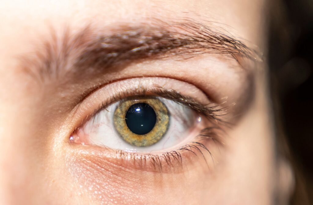 A person's greenish-brown eye is freshly dilated; the pupil is large and black.