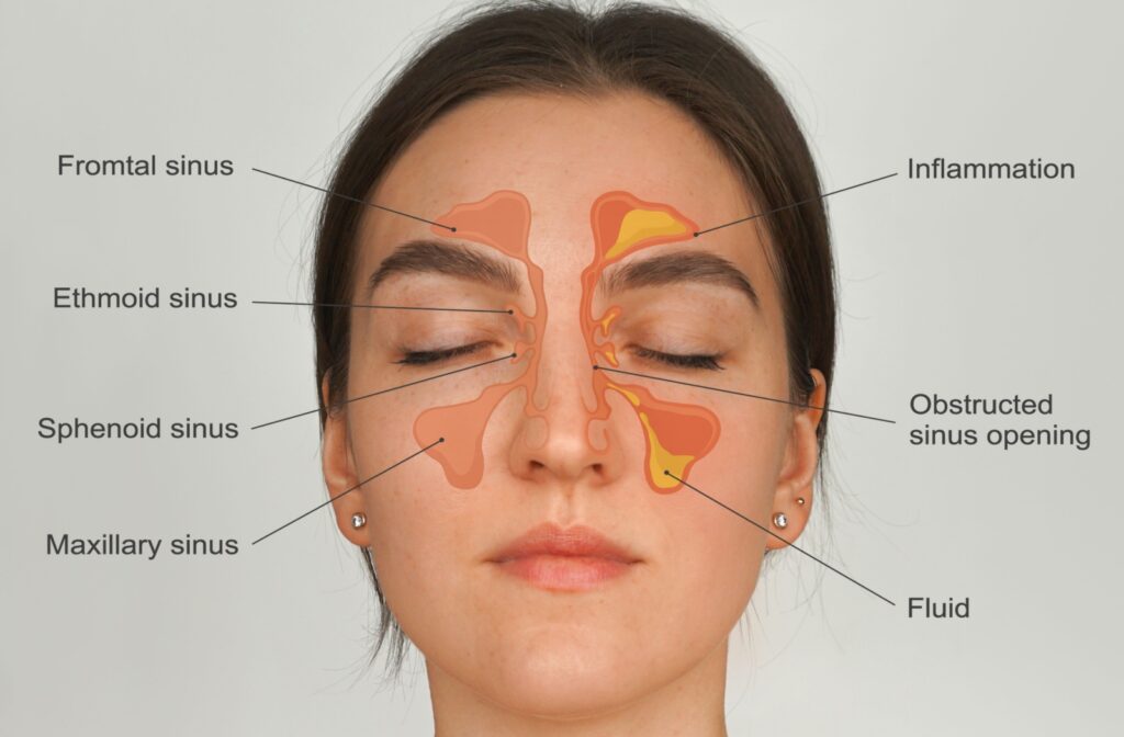 A diagram showing the sinuses and their proximity to the eyes.
